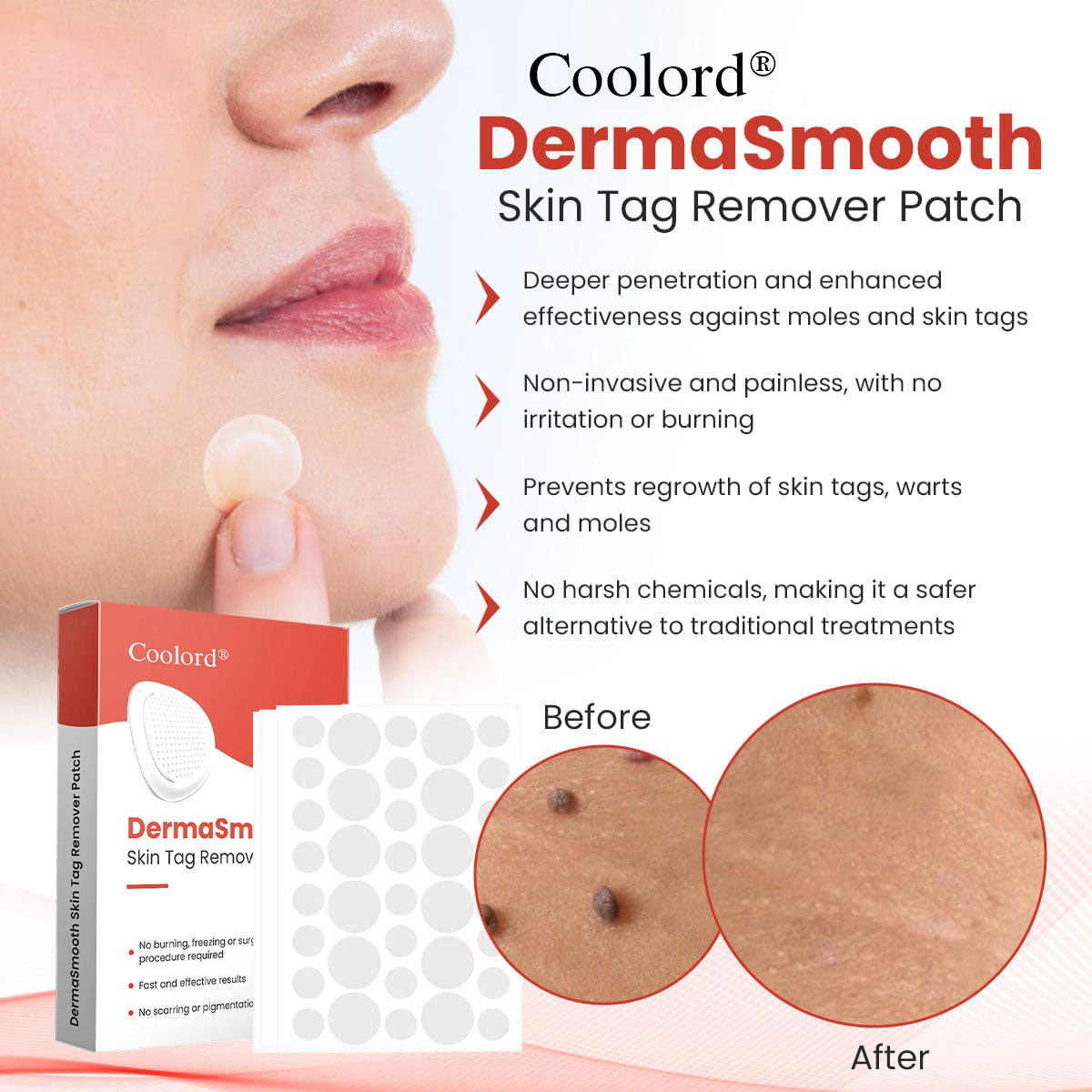 Coolord® DermaSmooth Skin Tag Remover Patch