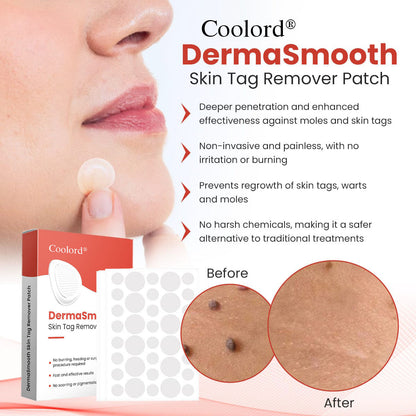 Coolord® DermaSmooth Skin Tag Remover Patch