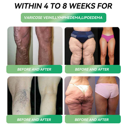 𝐶𝑅𝑂𝐴𝐼𝐸® 𝐆𝐋𝐏-𝟏 𝐒𝐥𝐢𝐦𝐦𝐢𝐧𝐠 & 𝐇𝐞𝐚𝐥𝐭𝐡 𝐔𝐥𝐭𝐫𝐚 𝐂𝐨𝐧𝐜𝐞𝐧𝐭𝐫𝐚𝐭𝐞𝐝 𝐄𝐬𝐬𝐞𝐧𝐜𝐞 𝐋𝐢𝐪𝐮𝐢𝐝 𝐁𝐞𝐚𝐝𝐬🌿-𝐍𝐀𝐃+&𝐌𝐨𝐫𝐢𝐧𝐠𝐚 & 𝐀𝐂𝐕 & 𝐊𝐞𝐭𝐨 𝐁𝐇𝐁(✅𝐬𝐩𝐞𝐞𝐝𝐲, 𝐥𝐨𝐧𝐠-𝐥𝐚𝐬𝐭𝐢𝐧𝐠, 𝐚𝐝𝐝𝐫𝐞𝐬𝐬𝐢𝐧𝐠 𝐝𝐢𝐚𝐛𝐞𝐭𝐞𝐬, 𝐨𝐛𝐞𝐬𝐢𝐭𝐲, 𝐚𝐧𝐝 𝐜𝐚𝐫𝐝𝐢𝐨𝐯𝐚𝐬𝐜𝐮𝐥𝐚𝐫 𝐝𝐢𝐬𝐞𝐚𝐬𝐞𝐬) ✅
